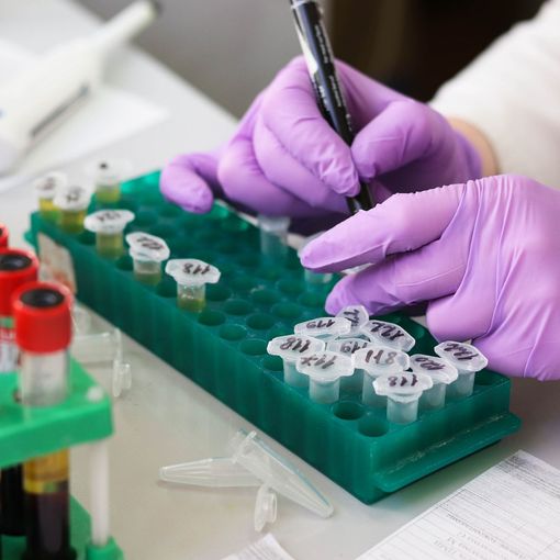 Coronavirus, ancora 7 decessi in Piemonte, ma 141 i pazienti guariti