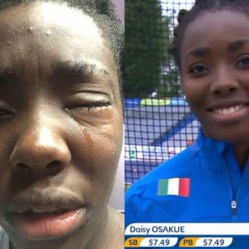 Daisy: presi gli aggressori della ragazza colpita da un uovo a Moncalieri