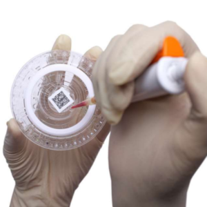 Presentazione di strumenti Point of Care Testing, appuntamento per nutrizionisti, ecco le date