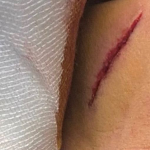 Un detenuto spacca la testa a un agente: il carcere di Torino sempre più nel baratro