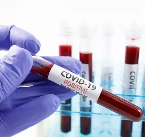coronavirus - foto di repertorio