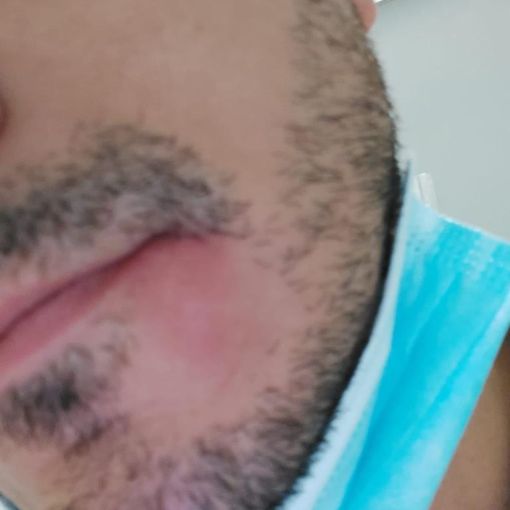 ispettore aggredito