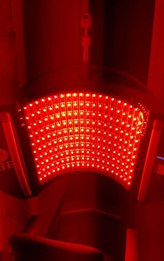 Il 74% delle apparecchiature utilizzate nei centri estetici piemontesi non sarebbe conforme alla normativa vigente