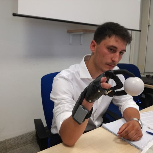 La storia di Lorenzo: con la tecnologia &quot;ritrova&quot; la mano che un petardo gli ha portato via a Capodanno [VIDEO]