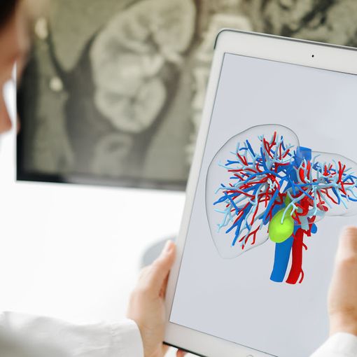 medico che osserva un'immagine