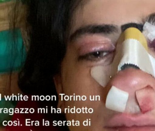 Il post della ragazza aggredita al White Moon