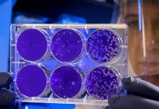 Covid: tutte le analisi del sangue per stare tranquilli