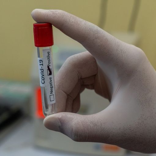 Altri 72 morti per il coronavirus in Piemonte, ma non aumentano le terapie intensive e calano i ricoveri in ospedale