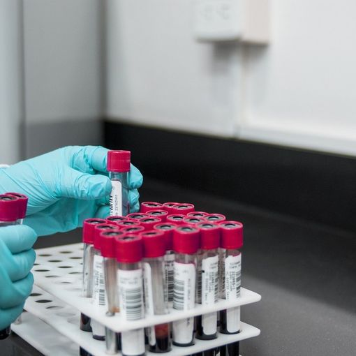 Coronavirus, quasi 4 mila test sierologici prenotati per il personale della scuola