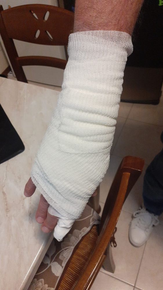 Detenuto straniero ricoverato all'ospedale di Ciriè va fuori di testa e picchia due agenti Detenuto straniero ricoverato all'ospedale di Ciriè va fuori di testa e picchia due agenti