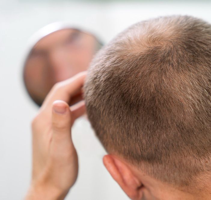 La Tua Guida Completa alle Patch Cutanee per la Crescita dei Capelli: Cosa Devi Sapere