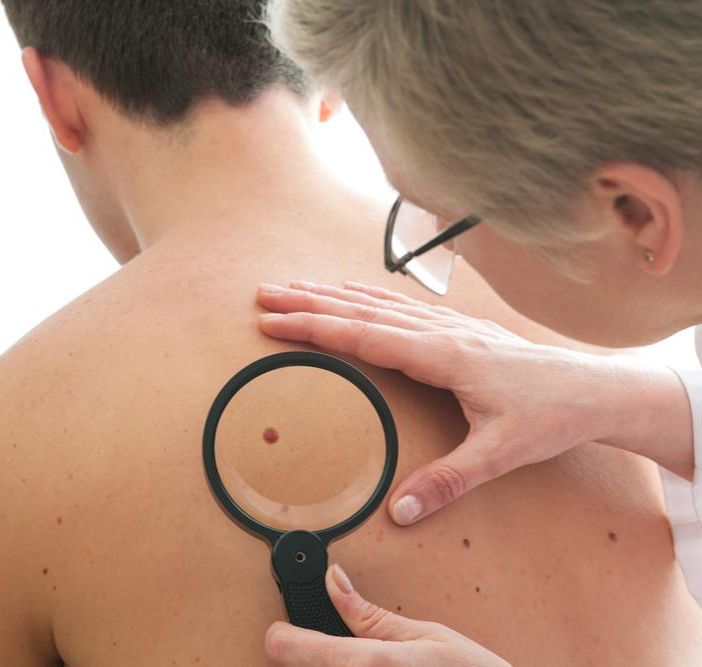 La &quot;Vitiligine Week&quot; arriva a Torino, incontri gratuiti con i dermatologi: le info