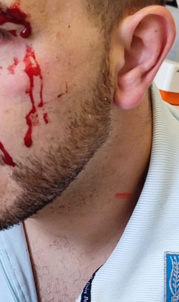 Carcere di Ivrea, detenuto aggredisce un poliziotto e gli spacca un sopracciglio. Osapp: &quot;Si dichiari lo stato di emergenza&quot;