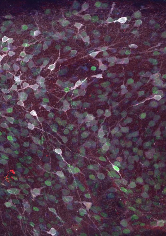 Una nuova frontiera per curare il Parkinson e le malattie neurodegenerative