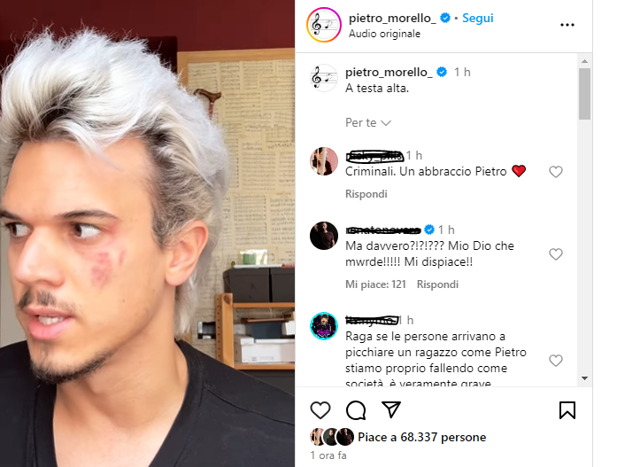 fotogramma di Instagram