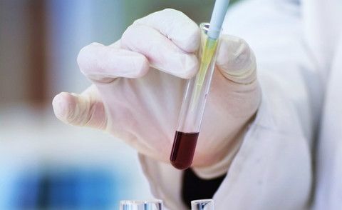 Tumore al pancreas: scoperta a Torino la chiave di ingresso per l’invasione dei linfociti killer