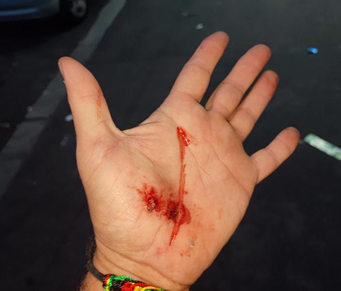 mano ferita mano ferita