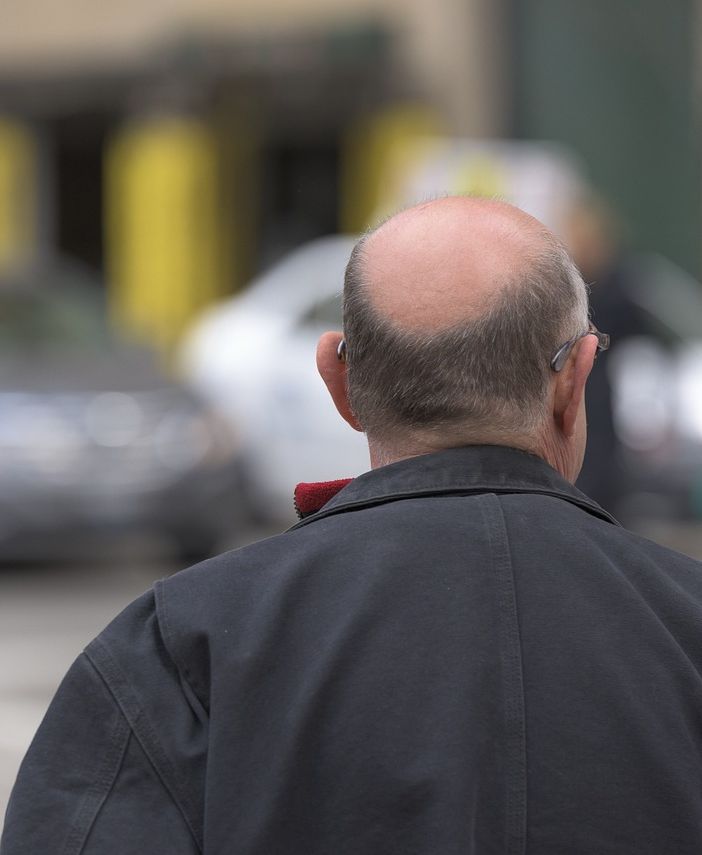 Come combattere diradamento e caduta dei capelli