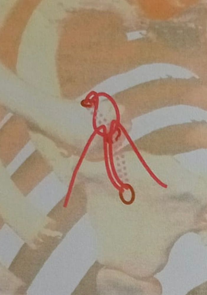 Esami medici di una clavicola