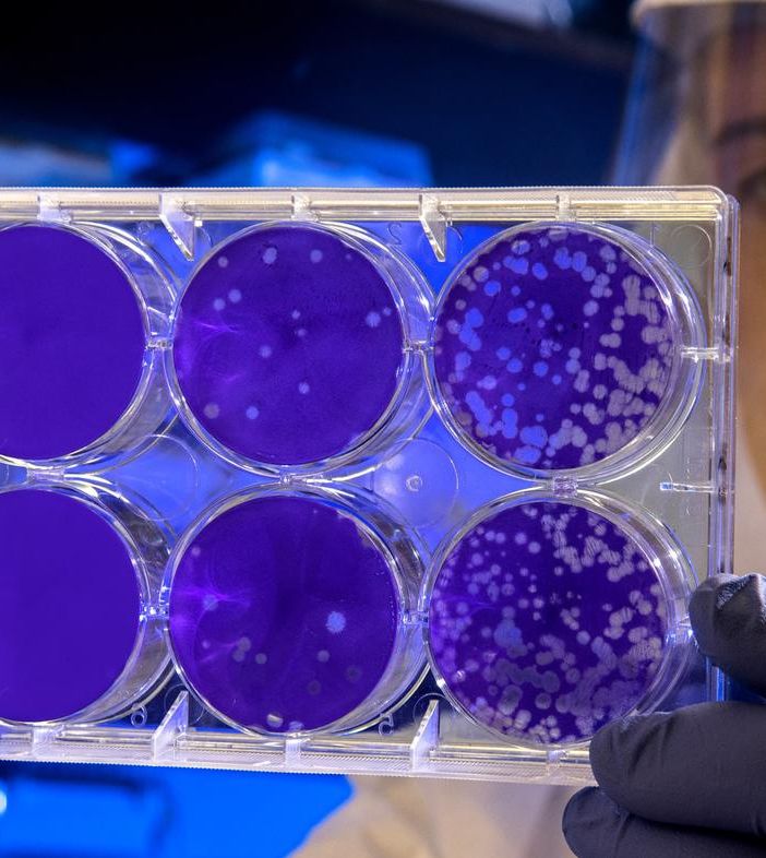 Coronavirus, oggi in Piemonte i guariti (232) sono quasi il triplo dei morti (82). Scendono (-13) i ricoverati in terapia intensiva