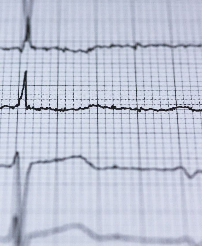 Come viene svolto un elettrocardiogramma