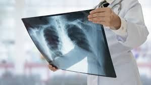 Radiologia, l'assessore Icardi: &quot;I sei nuovi assunti a Rivoli seguiranno anche Grugliasco e Avigliana&quot;