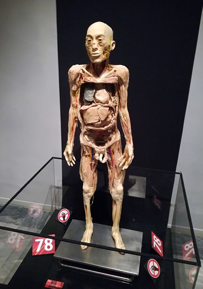 Human Bodies, il corpo umano si rivela agli occhi dei torinesi (e cerca di schivare le polemiche)