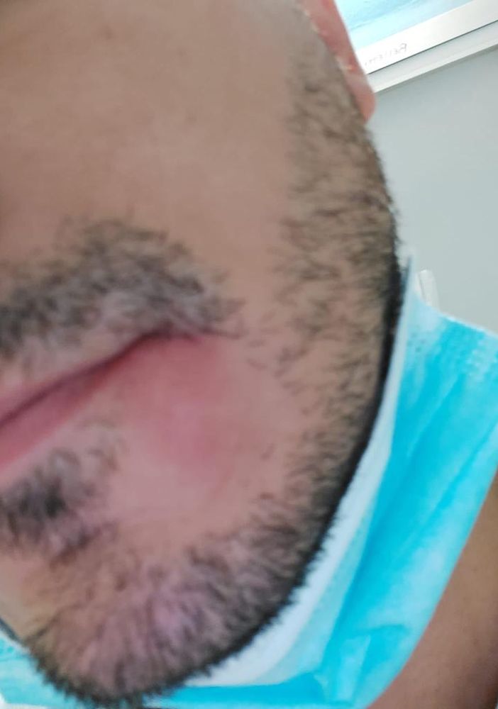 ispettore aggredito