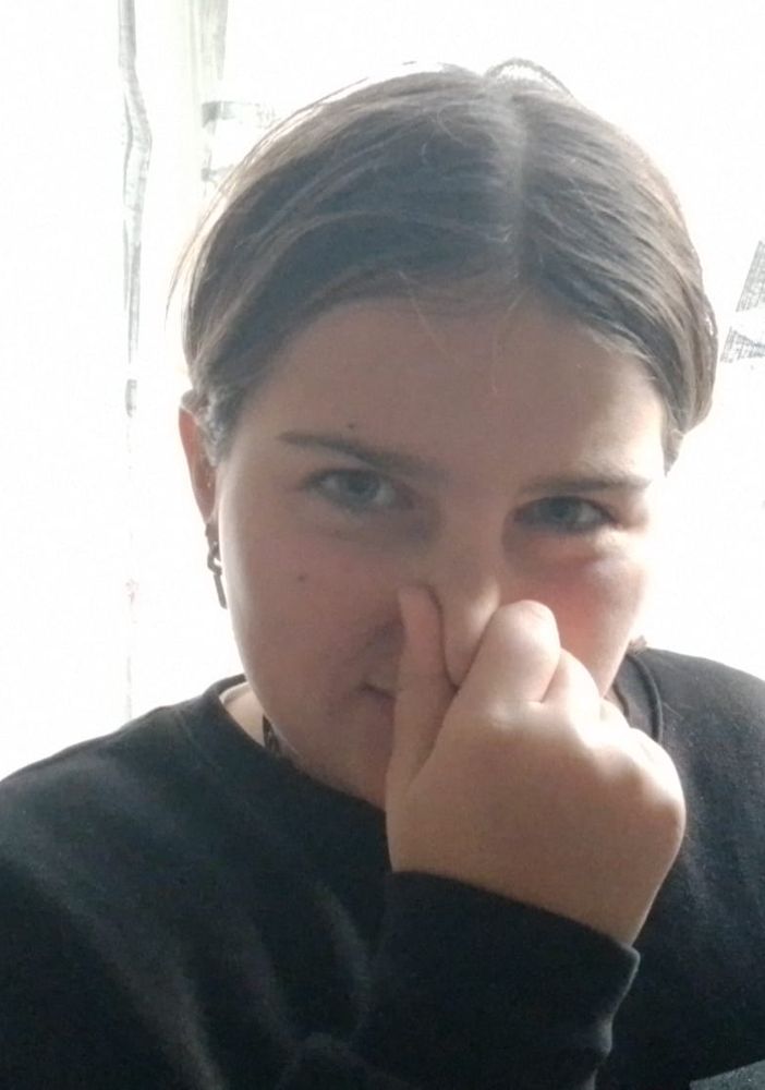 bimba naso tappato