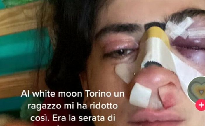 Il post della ragazza aggredita al White Moon