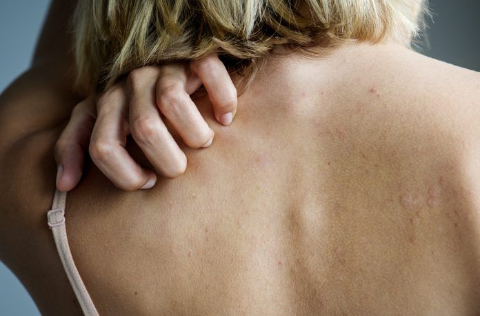 Rash cutaneo: cause e rimedi
