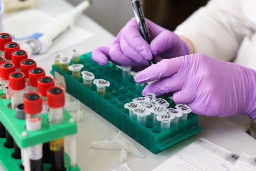 L'accusa del Nursind: &quot;Diverse Asl cercano il Covid con un solo tampone invece che due&quot;