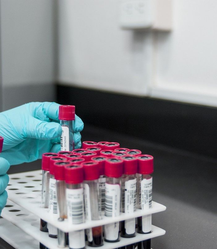Coronavirus, quasi 4 mila test sierologici prenotati per il personale della scuola