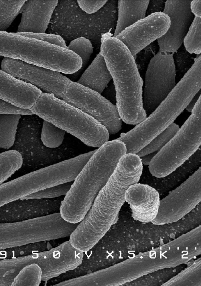 E. Coli Bacteria - Credit: NIAID