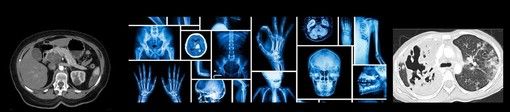 A Torino le “Giornate dei Giovani Internisti Piemontesi” organizzate dal medico del Santa Croce di Cuneo Luigi Fenoglio