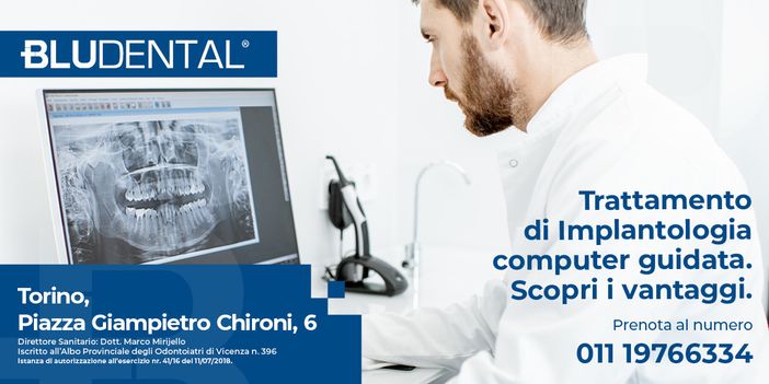 Implantologia computer guidata - la tecnologia a servizio del benessere