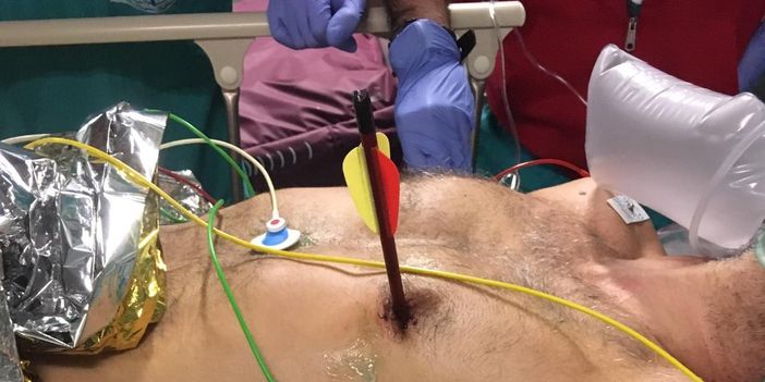 Arriva in ospedale con una freccia piantata nel cuore: salvato alle Molinette con un intervento senza precedenti Arriva in ospedale con una freccia piantata nel cuore: salvato alle Molinette con un intervento senza precedenti