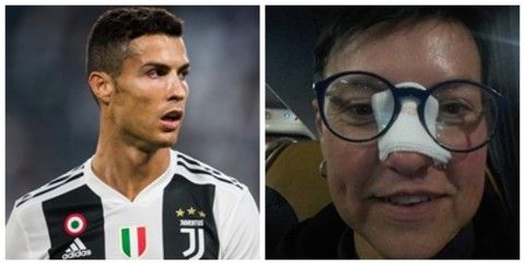 CR7 colpisce ancora… ma il naso di Elena! "Incontro ravvicinato" a Torino con il suo idolo per una tifosa monregalese
