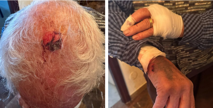 Le immagini dell'aggressione dell'86enne in via Boccherini Le immagini dell'aggressione dell'86enne in via Boccherini