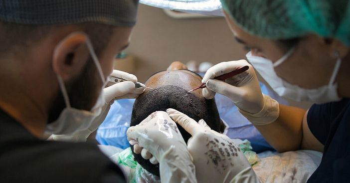 Le Migliori Cliniche per il Trapianto di Capelli in Turchia da Conoscere nel 2025