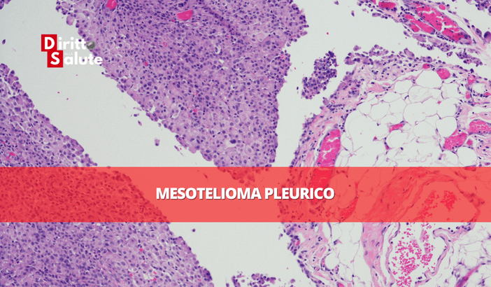 Amianto ad alta quota: causa pilota di condanna di ATITECH per risarcimento danni