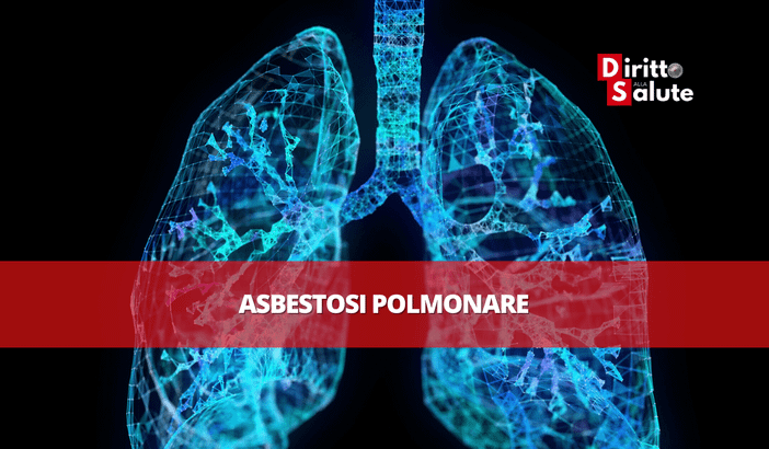 Ali di amianto: il TAR del Lazio condanna il Ministero della Difesa al risarcimento, per asbestosi