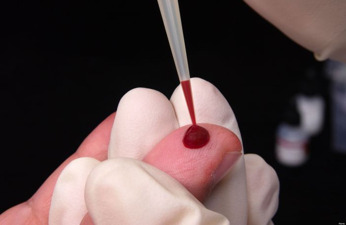 Lotta all'Hiv: a Torino 1300 test l'anno grazie al progetto Fast Track City
