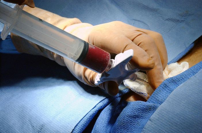 Donazione degli organi, Torino fuori dalla classifica delle 30 città italiane più generose