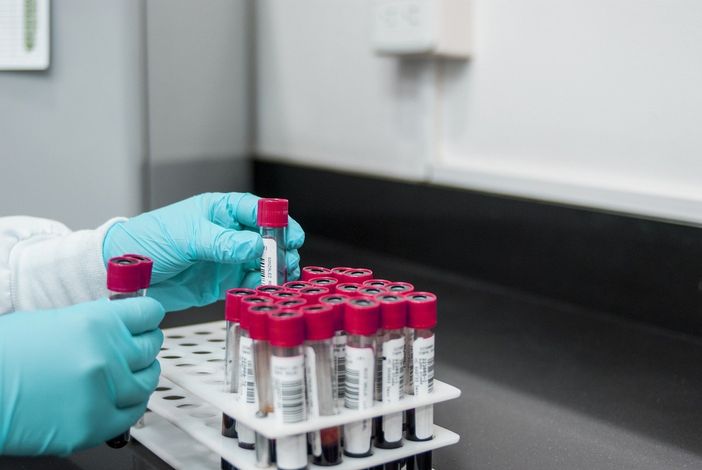 Coronavirus, in Piemonte al via lunedì 4 maggio i test sierologici sul personale del servizio sanitario