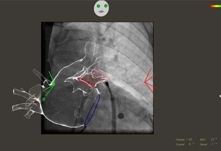 L'intelligenza artificiale arriva in Cardiologia: importante novità alle Molinette di Torino L'intelligenza artificiale arriva in Cardiologia: importante novità alle Molinette di Torino