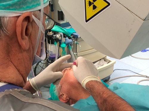 Il trattamento risolutivo e incruento per la nevralgia del trigemino