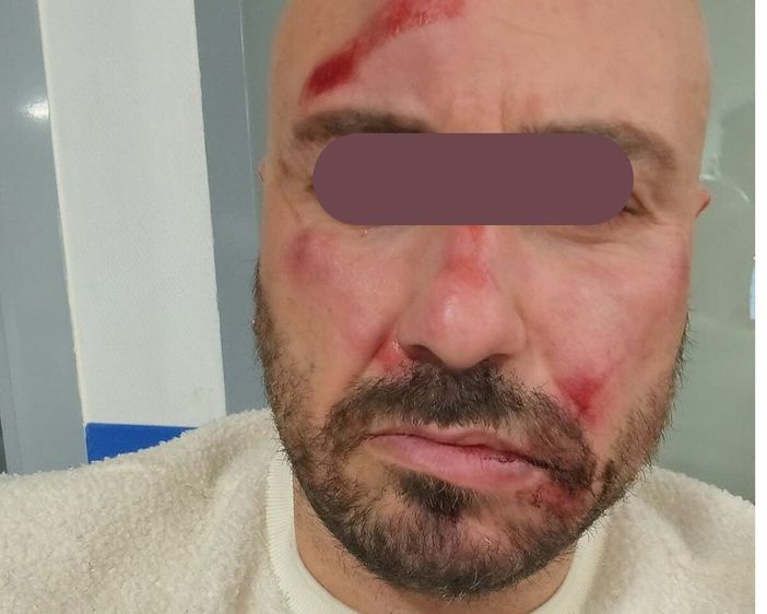 Filippo, la vittima dell'aggressione Filippo, la vittima dell'aggressione