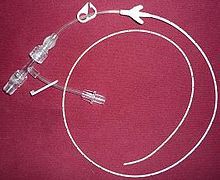 Ospedale di Rivoli: impianto di Picc (catetere centrale ad inserzione periferica) su una ragazzina di 11 anni Ospedale di Rivoli: impianto di Picc (catetere centrale ad inserzione periferica) su una ragazzina di 11 anni