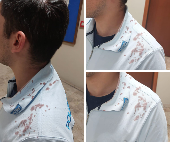 Rivolta carcere, agente colpito alla testa con una bomboletta. Osapp: "Chiediamo l'invio dei Gruppi Speciali" Rivolta carcere, agente colpito alla testa con una bomboletta. Osapp: "Chiediamo l'invio dei Gruppi Speciali"